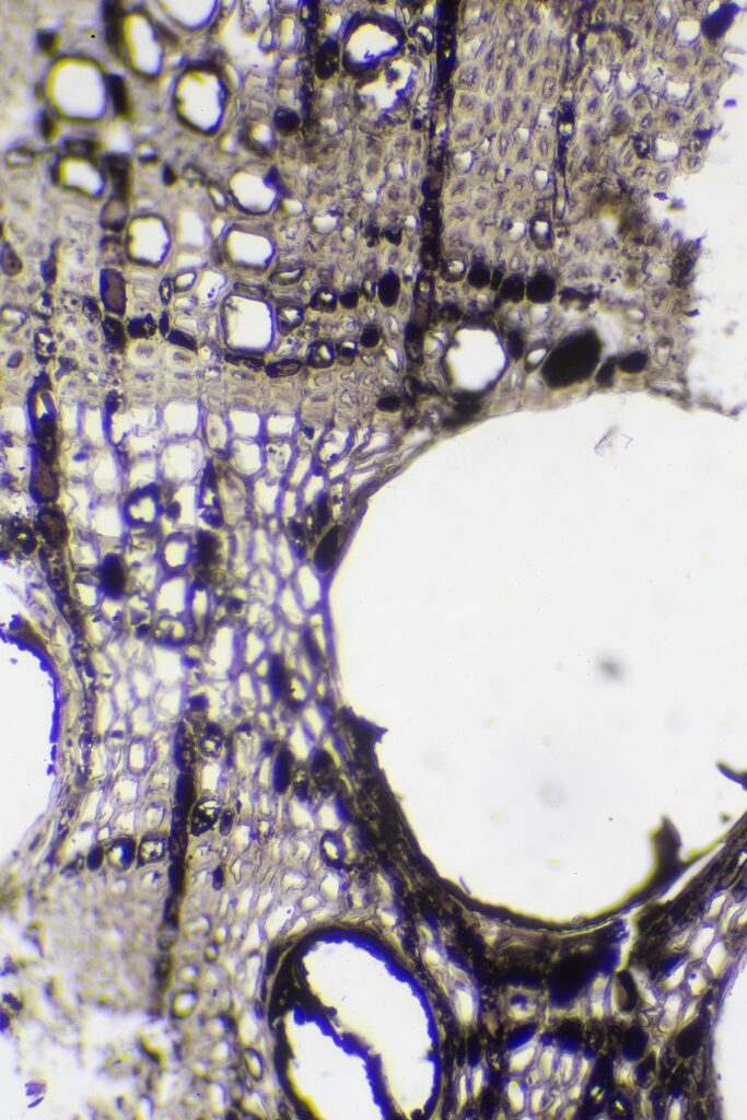 Castanea sp. - coupe transversale